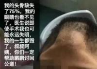 虐打男童被判刑 为什么引争议究竟是怎么回事？