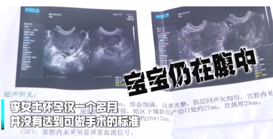 6月12日,湖南一女子在一家医院做流产手术,进行50分钟后手术突然终止,医生说的一句话
