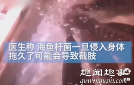 近日,广东深圳一市民手上出现“大窟窿”急忙就诊,医生一看当场惊了