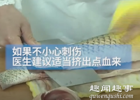 近日,广东深圳一市民手上出现“大窟窿”急忙就诊,医生一看当场惊了