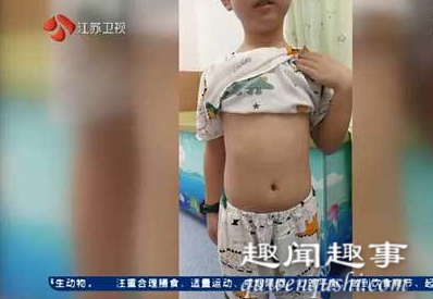 浙江杭州8岁男孩全身变黄查不出病因 外公一句话道破可怕真相