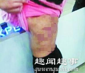 震惊!班主任发现10岁女孩衣服渗血 送到医院一查真相让网友炸锅