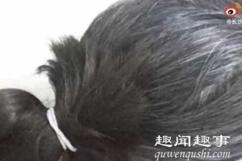 湖南一30岁女子长白头发每天吃何首乌,一个月后身体的变化太吓人。