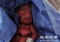 近日,一名早产婴儿被宣布死亡,放太平间6小时,抱出来一刻全家都崩溃了。